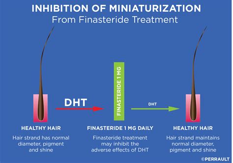 finasteride mechanism of action hair loss